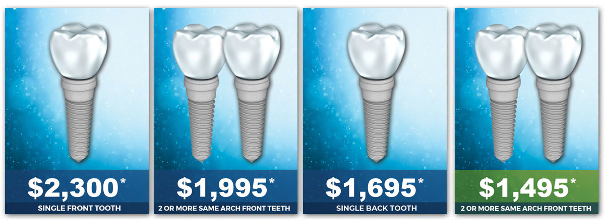 Dental Implant Cost 2021 