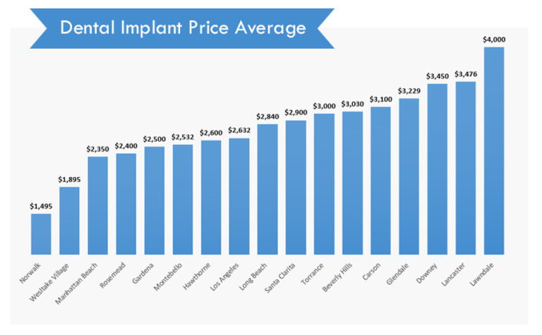 Dental Implant Price Average La 768x475 